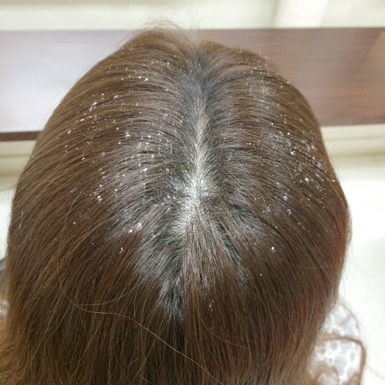 くわも、桑本、affect、アフェクト